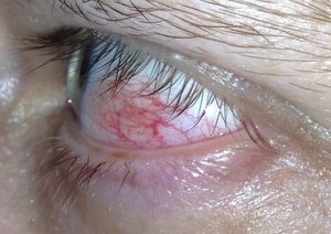 B9C46BE1-3B42-4208-85A5-D269A6521AEE.JPG (2158 просмотров) <a class='original' href='./download/file.php?id=15518&mode=view' target=_blank>Загрузить оригинал (55.07 КБ)</a>