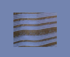 Платье (2543 просмотра) <a class='original' href='./download/file.php?id=44479&mode=view' target=_blank>Загрузить оригинал (61.62 КБ)</a>