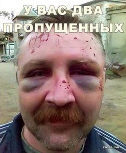 d711bf21-b4b9-45e7-b8db-cccd8d7a7626.jpg (2472 просмотра) <a class='original' href='./download/file.php?id=69452&mode=view' target=_blank>Загрузить оригинал (30.34 КБ)</a>