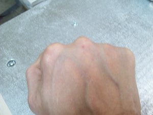 Фото не гуглить, бесполезно... Не толерантно, конечно, но эффективно. Проверено. Как врач, не рекомендую. (1923 просмотра) <a class='original' href='./download/file.php?id=70768&mode=view' target=_blank>Загрузить оригинал (462.36 КБ)</a>